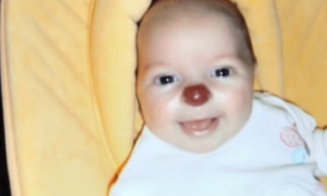 Dziewczynka z nosem klauna fot. YouTube