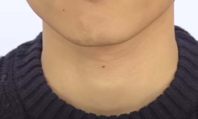 Pieprzyk na twarzy/YouTube @Off the Great Wall