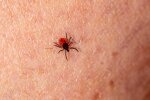 Naukowcy znaleźli prosty sposób na kleszcze. Ta metoda może działać jak ochronna bariera