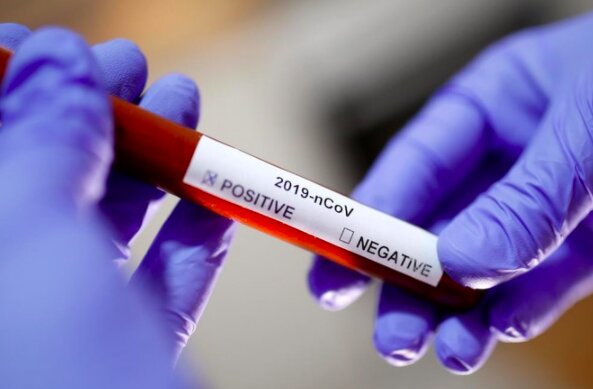 Przybywa zakażeń na Dolnym Śląsku / arabnews.com/