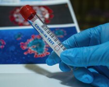 Małopolska: smutne wiadomości z sanepidu. Są nowe dane odnośnie pandemii koronawirusa na poniedziałek