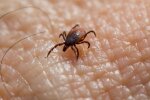 Domowy sposób na kleszcze. Ten zapach może pomóc odstraszyć groźne pajęczaki