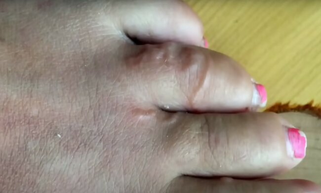 źródło: YouTube/CTV News