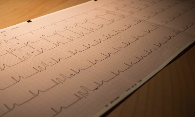 EKG @pexels
