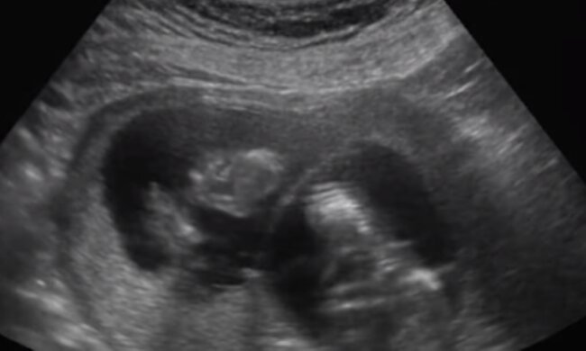 USG/YouTube @kciukciek