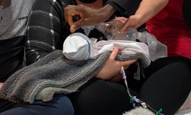 Pierwsze na świecie "dziecko ryba". Chłopiec urodził się z płetwą