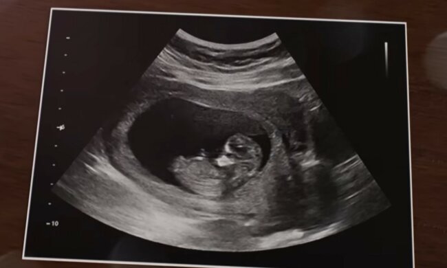 screen Youtube @telekanal u