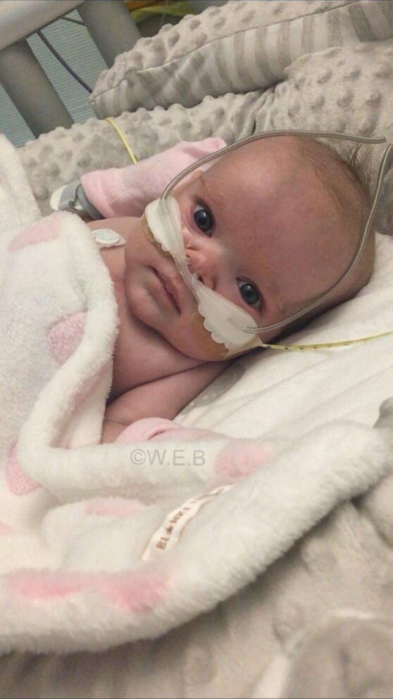 6-miesięczna dziewczynka pokonała koronawirusa, źródło: ABC News