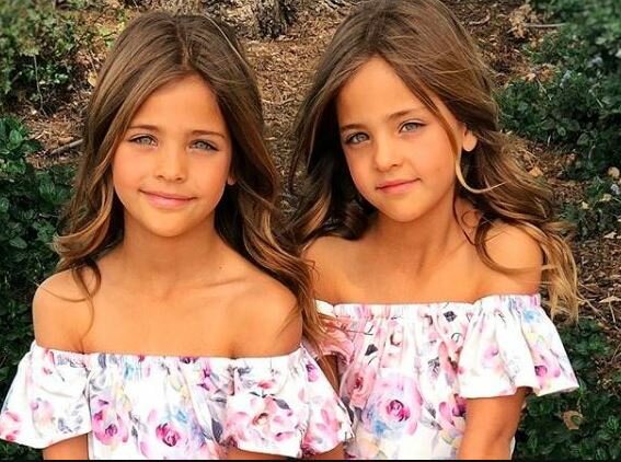 Najpiękniejsze bliźniaczki na świecie. Źródło: pikio.pl