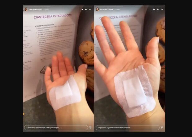 Kasia Cichopek pokazuje opatrunek na ręce/Instagram @Kasia Cichopek