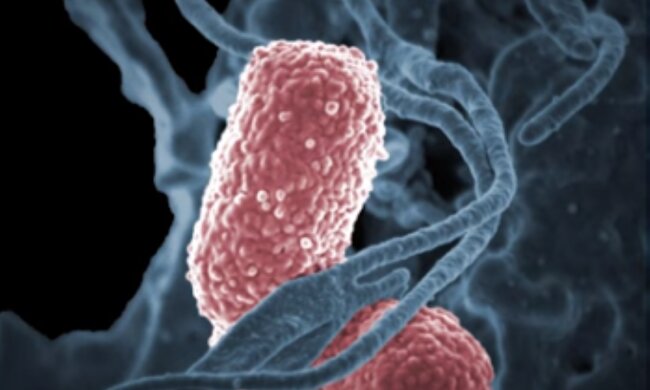 Bakteria Klebsiella pneumoniae/YouTube @umichpath
