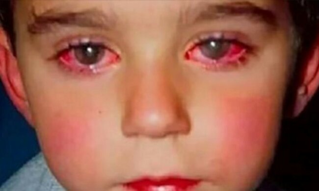 Niewinna zabawka pozbawiła dziecko najważniejszej rzeczy. Mały chłopiec stracił 75% wzroku w wyniku popularnego zakupu rodziców