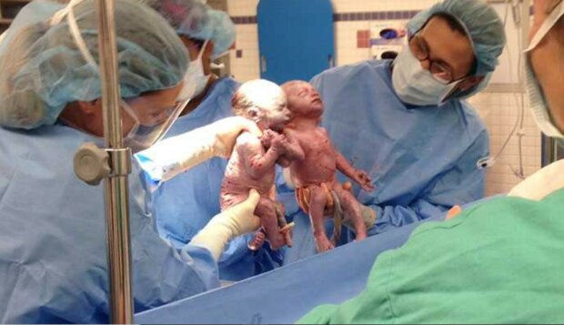 Bliźniaczki urodziły się trzymając się za ręce,screen Google