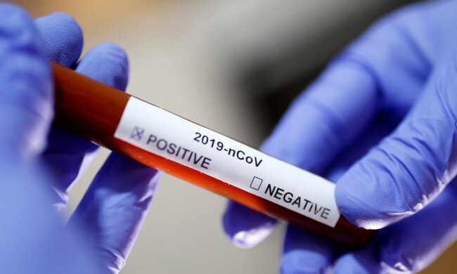 02.06.2020 rok. Wciąż płyną smutne wieści z Ministerstwa Zdrowia. Pojawiły się nowe statystyki zakażeń