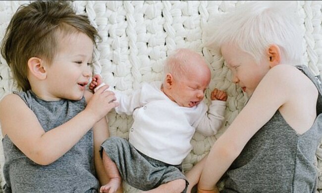 chłopiec, który urodził się z siwymi włosami, screen Dailymail.co.uk