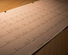 EKG @pexels