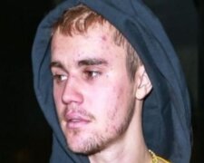 Justin Bieber ujawnia prawdę o swoim stanie zdrowia. Gwiazdor jest nieuleczalnie chory