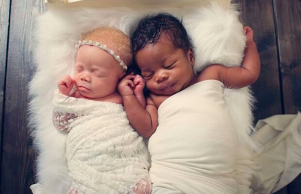 Niesamowite bliźniaki! / Instagram: @black_n_white_twins