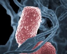 Bakteria Klebsiella pneumoniae/YouTube @umichpath