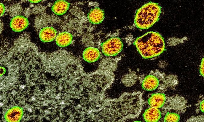 Ważne wieści płyną z Ministerstwa Zdrowia. Wydano pilne oświadczenie o ważnych dla zdrowia zasadach. Co widnieje w apelu resortu