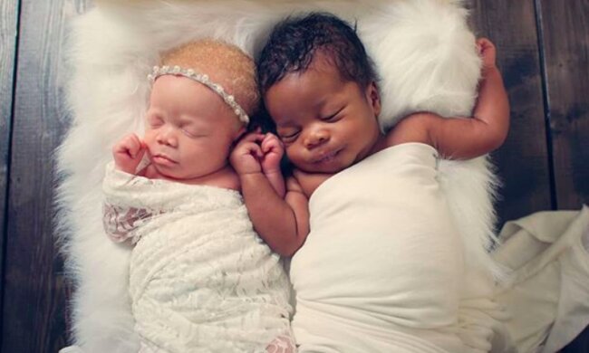 Niesamowite bliźniaki! / Instagram: @black_n_white_twins
