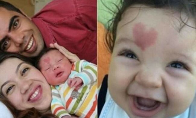 Dziecko urodzone ze znamieniem na czole, screen Google