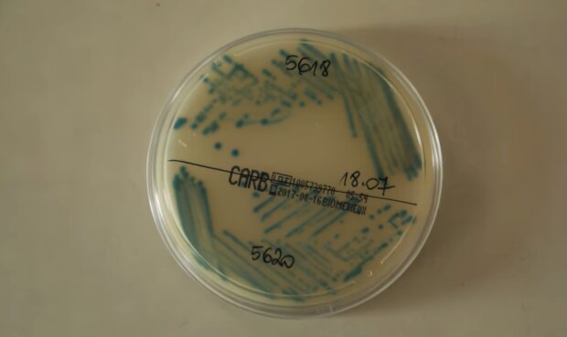 Bakteria KPC/YouTube @Onet News