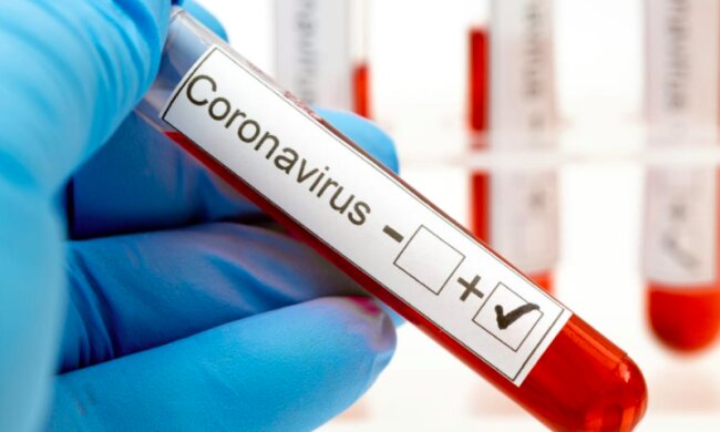 Koronawirus w krakowskim liceum/ pymnts.com