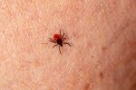 Kleszcze są już wszędzie. Jedno ukąszenie może skończyć się poważnymi problemami. Tak ochronisz siebie, dzieci i zwierzęta