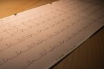 EKG @pexels