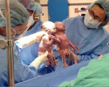 Bliźniaczki urodziły się trzymając się za ręce,screen Google