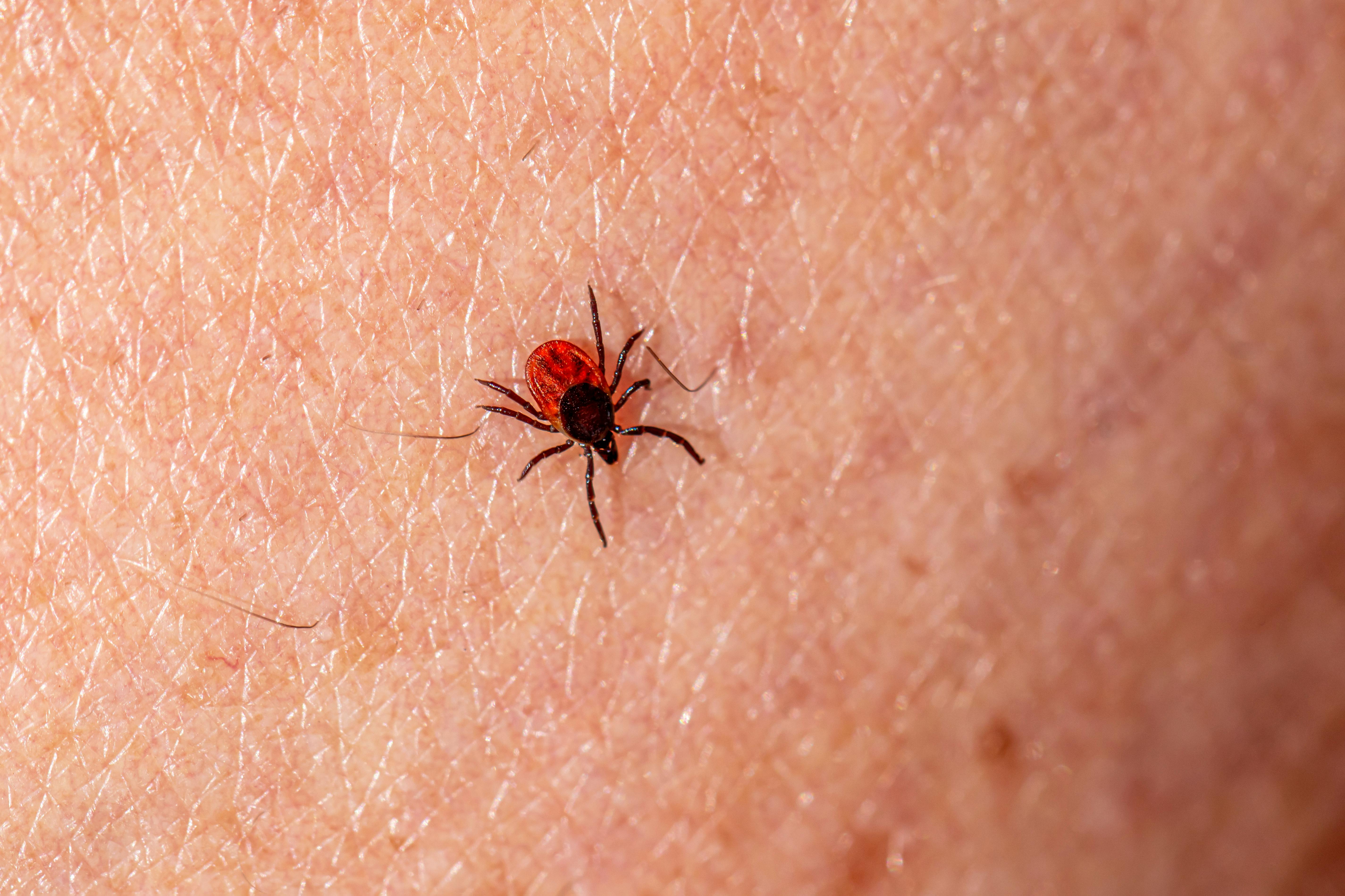 Kleszcze są już wszędzie. Jedno ukąszenie może skończyć się poważnymi problemami. Tak ochronisz siebie, dzieci i zwierzęta